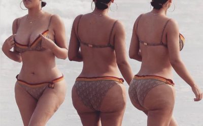 Ritenzione idrica e cellulite: guida semplice