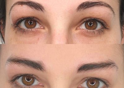 Microblading - Sopracciglia